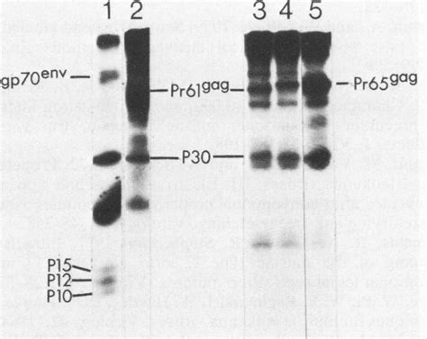 Analysis of virion proteins released into the medium by cells ...