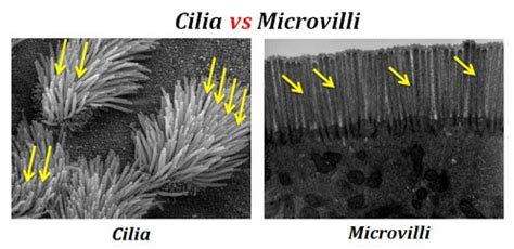 Difference between Cilia and Microvilli | EasyBiologyClass