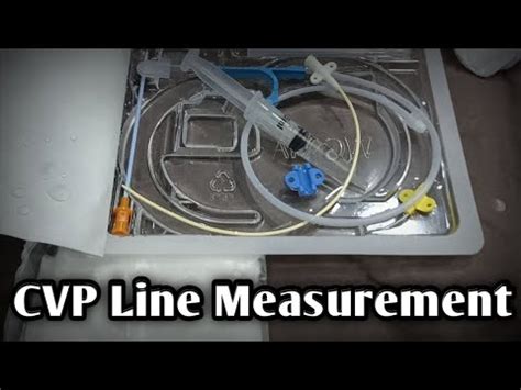 How To CVP Line Catherter Measurement | CVP Line Measurement | CVP Line ...