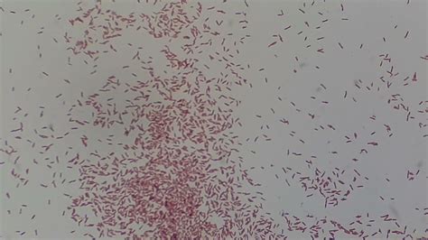 Gram Negative Rods/ Bacilli of Pseudomonas aeruginosa Microscopy - YouTube