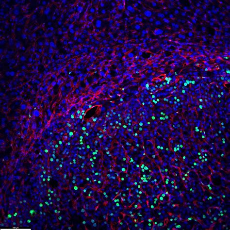 Researchers identify hormone from fat cells that restrains tumor growth ...