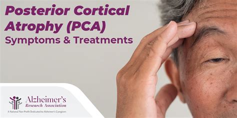 Posterior Cortical Atrophy (PCA): Symptoms & Treatments - Alzheimer's ...