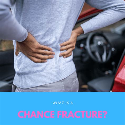 What Is A Chance Fracture? | New Jersey | Comprehensive Spine Care