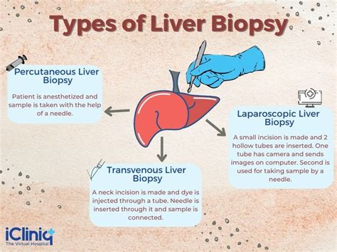 What Is Laparoscopic Liver Biopsy?