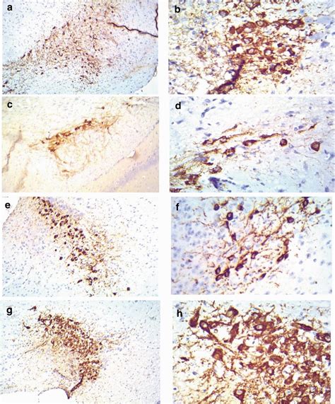 Immunohistochemical staining for tyrosine hydroxylase enzyme in the ...