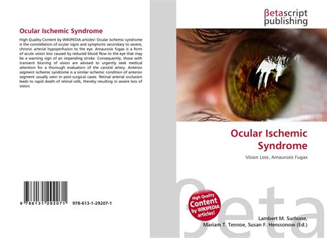 Ocular Ischemic Syndrome, 978-613-1-29207-1, 6131292078 ,9786131292071