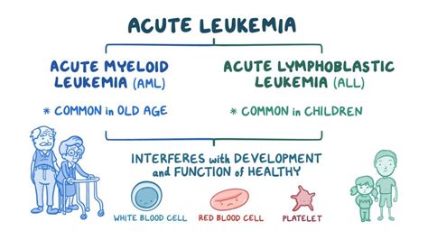 Acute Lymphoblastic Leukemia In Children