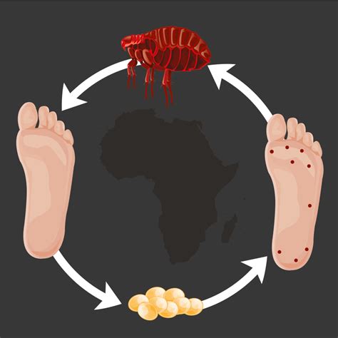 Sand Flea Bites on Humans – Pictures, Treatment and Prevention