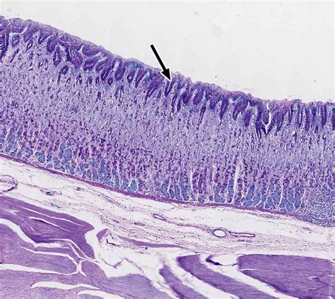 Pharynx, Esophagus, and Stomach | histology