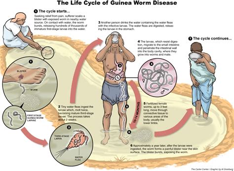 Guinea Worm Eradication Program at The Carter Center