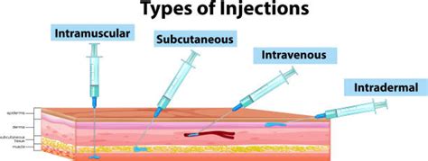 Types Of Injection Sites