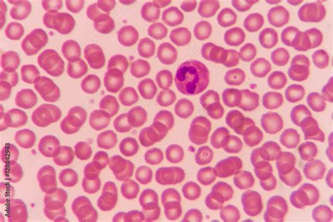 Normal red blood cells Under the microscope Stock-Foto | Adobe Stock