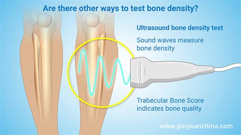 News - Bone Health Made Easy: Why Most People Should Always Have an ...