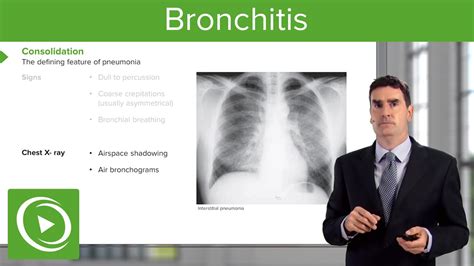 How to get rid of acute bronchitis fast - Acute bronchitis treatment