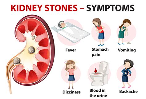 Common signs of Kidney Stones and its prevention | CFKC