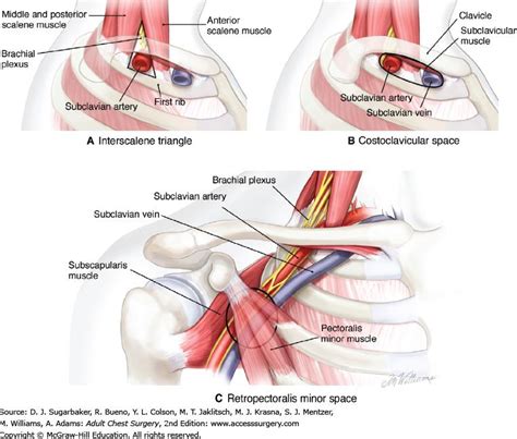 Thoracic Outlet Syndrome- Symptoms Diagnosis - Health | RXharun