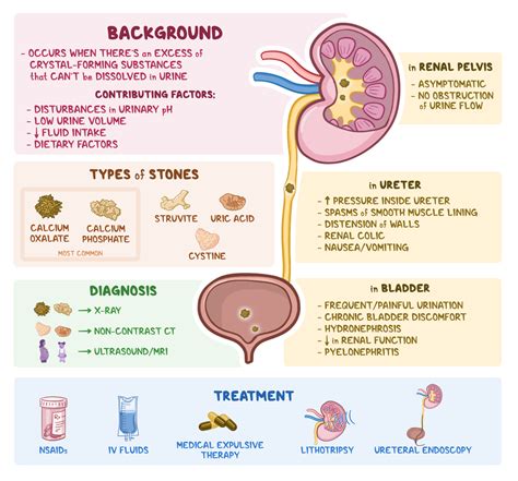 Osmosis - Nephrolithiasis: What Is It, Types, Signs and Symptoms ...