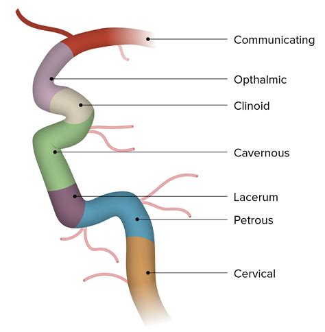 Sistema Arterial Carotídeo: Anatomía | Concise Medical Knowledge