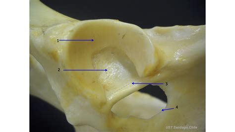 Acetabulum Diagram | Quizlet