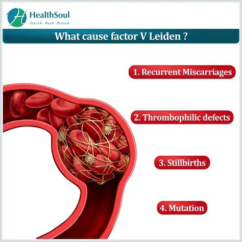 Factor V Leiden: Symptoms, Causes, and Treatment - Healthsoul