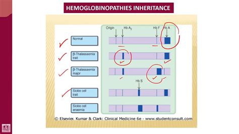 Hemoglobin Electrophoresis Test