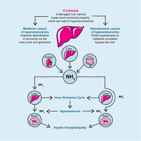 Liver Disease Hepatic Encephalopathy Fatty Liver Hepatitis Png | Images ...