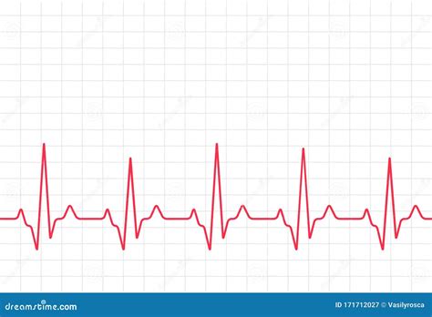 ECG Heartbeat Monitor, Cardiogram Heart Pulse Line Wave ...