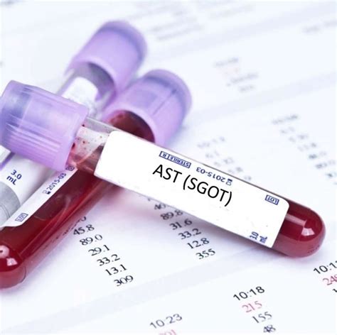 AST SGOT Blood Test - Normal Range, Causes of High AST