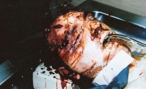 A post mortem photo of Jeffrey Dahmer after being beat to death by ...