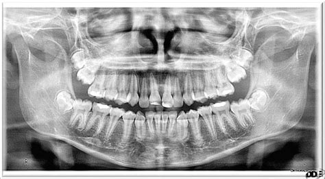 X-ray Safety / Image Gently | Beautiful Smiles