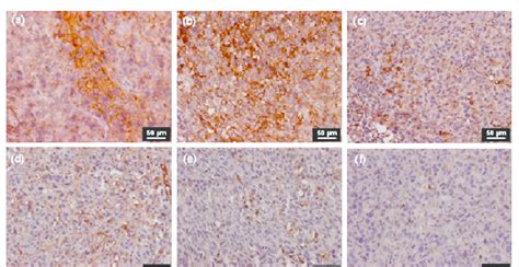 EGFR expression was assessed in tumors treated with various treatment ...