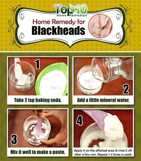 Home Remedies to Get Rid of Blackheads Fast | Top 10 Home Remedies