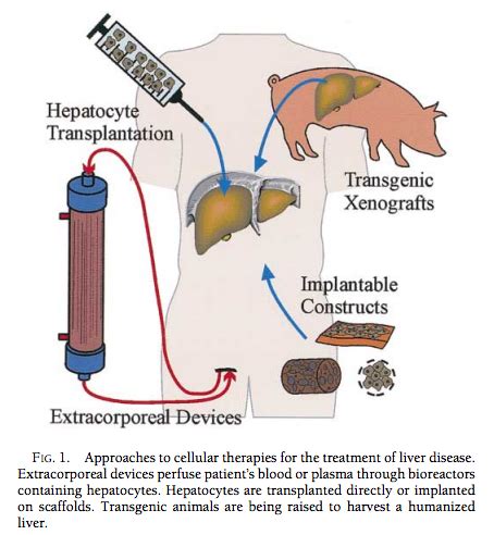 plasmapheresis procedure steps