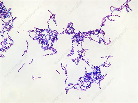 Streptococcal Pharyngitis Bacteria Shape