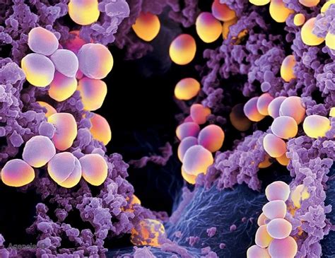 Diabetes: El secreto de la virulencia de las superbacterias en infecciones