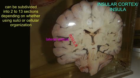Insular Lobe