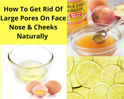 How To Get Rid Of Large Pores On Face, Nose, Cheeks Naturally