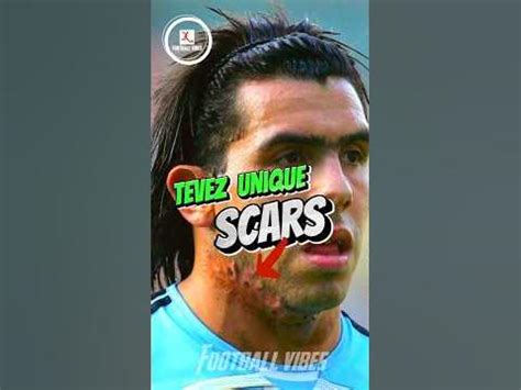 😱The Secret Behind Carlos Tevez Scars! “Shocking”😱 #football # ...