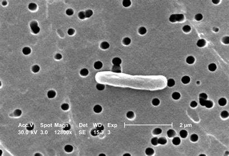 E Coli Micrograph