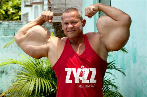 Muscle addict Arlindo de Souza injects OIL and ALCOHOL into his arms to ...