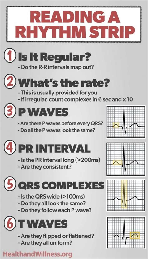 How to Read an EKG Rhythm Strip | Health And Willness