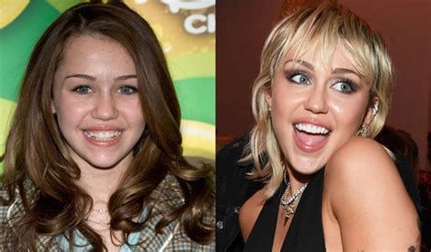 Celebrities Who Had Braces - Wilkinson Orthodontics - Gold Coast ...