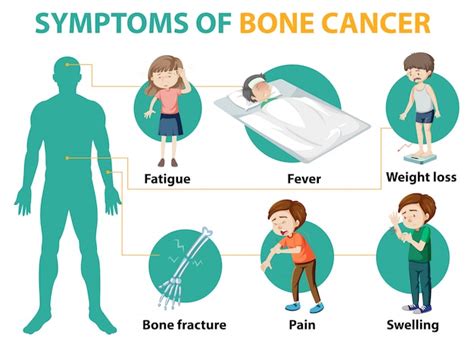 Cancer De Hueso Sintomas Signos Tratamiento Causas Y Etapas Images ...