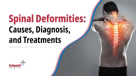 Spinal Deformities: Causes, Diagnosis & Treatments