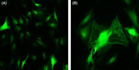 Figures of the transfected nucleus pulposus cells under an inverted ...