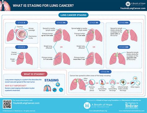 Staging Of Lung Cancer Chart