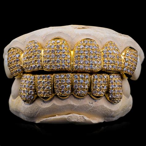 Buy Natural Diamond Grillz - Custom Gold Grillz