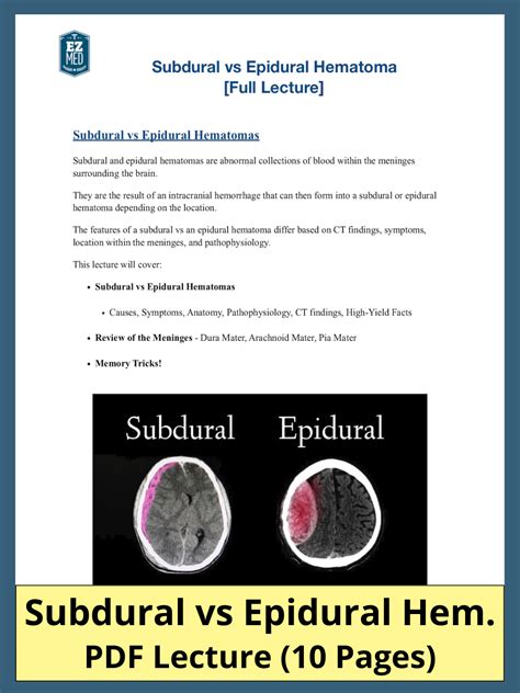 Subdural vs Epidural Hematoma PDF: Symptoms, Causes, CT, Radiology ...