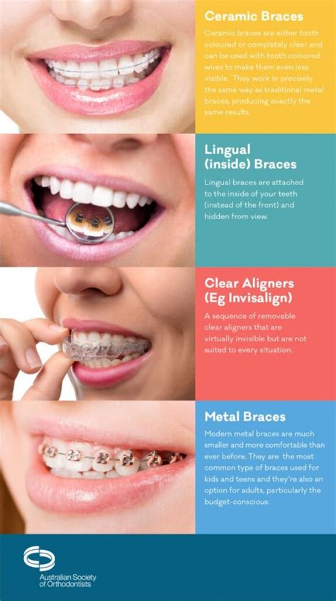 Braces For Adults: What Are The Orthodontic Treatment Options?