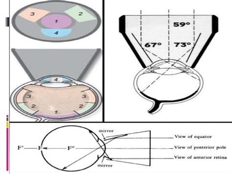 Gonioscopy: gonioscopic lenses, principle and clinical aspects